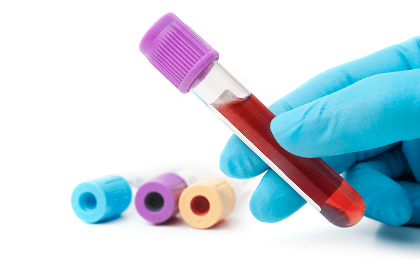 Veterinary Diagnostics - Blood Tests | Sky Canyon Veterinary Hospital | Grand Junction, Colorado
